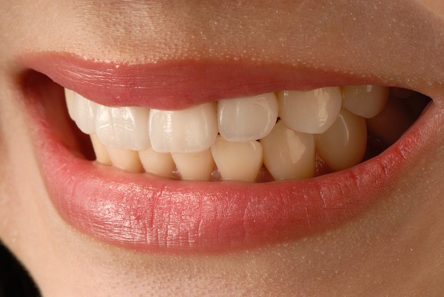 bruxisme tandenknarsen klachten kaak fysiotherapie